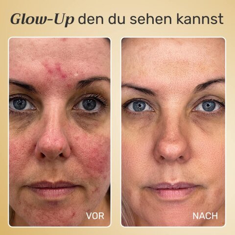 NuroDerma image